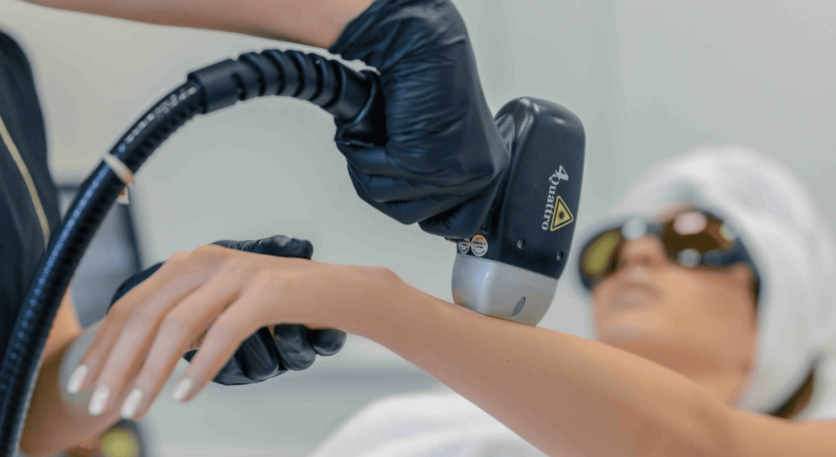 Permanent Laser Hair Removal with Soprano Titanium